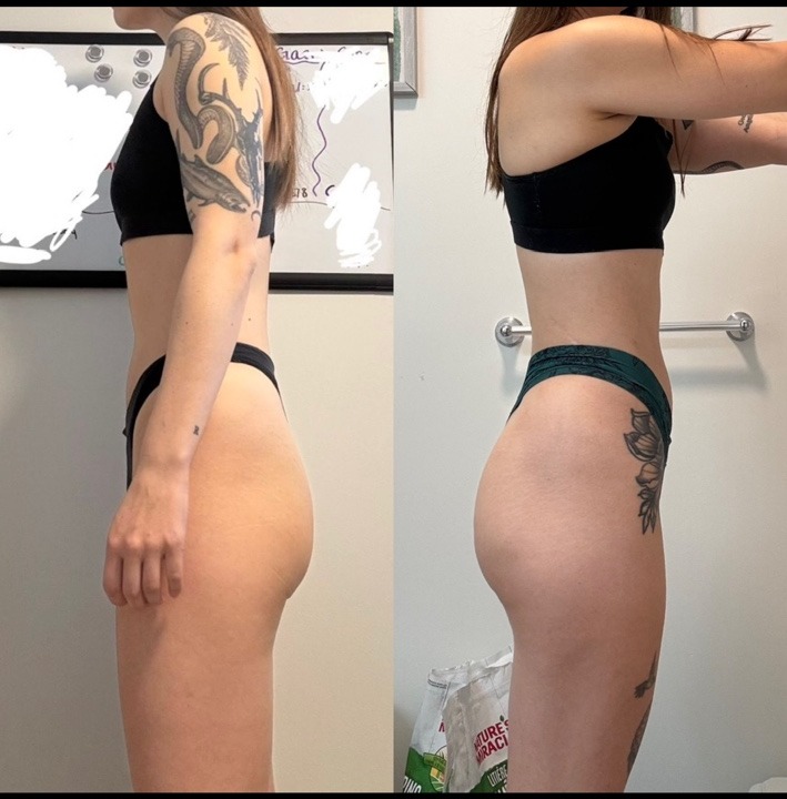 Client glute development before and after